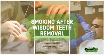 Can you use weed after wisdom teeth procedure