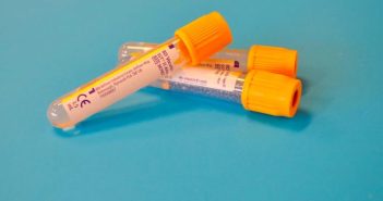 how long does weed stay in your urine