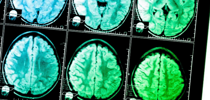 what weed does to your brain